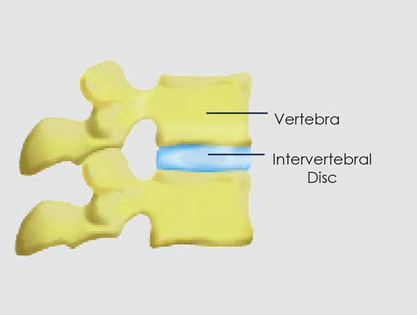 Disc Herniation- Randolph County Chiropractic - Amy Bradley